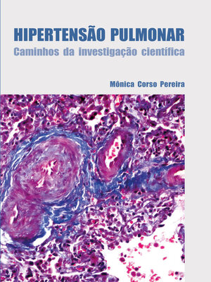 cover image of Hipertensão pulmonar